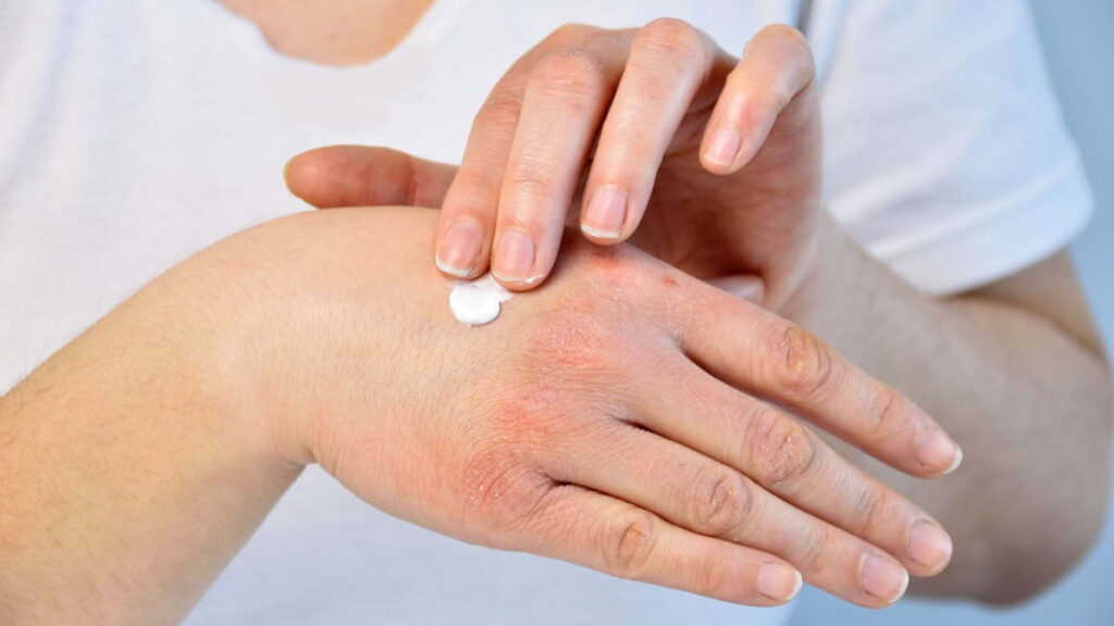 De ce se usucă pielea toamna și când nu mai e suficientă o cremă hidratantă? Ce spune medicul dermatologul